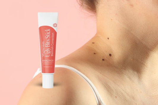 How to Remove Skin Tags Naturally: Does a Magnesium Stick Work?