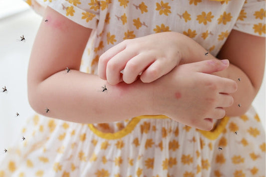 Is Sandalwood Good for Mosquitoes? (Yes & Here’s How to Use It Safely)