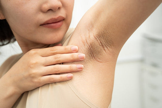 What Ingredients Should I Avoid In Deodorant — Especially With Sensitive Skin?